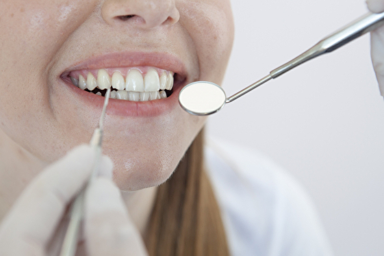 前歯はインプラントにするべき？前歯の治療の最適解を解説